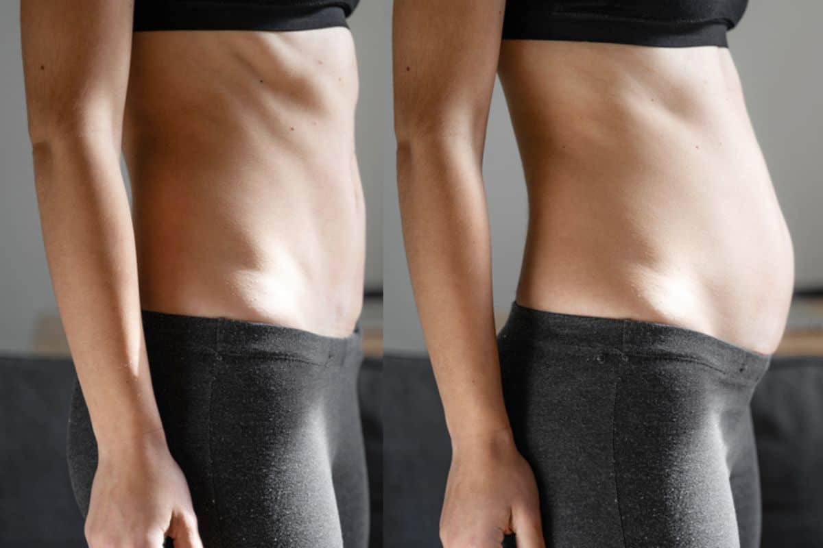 How long does diastasis recti take to improve Yeading?