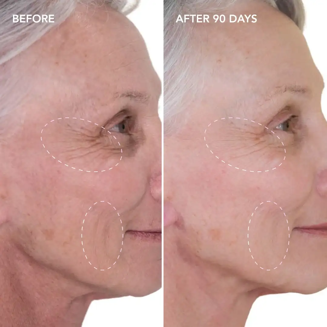 When will you see results Yeading